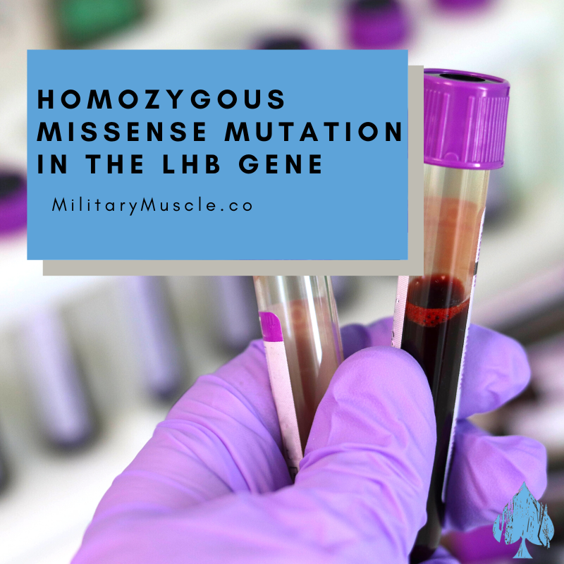 Hypogonadism Caused by a Homozygous Missense Mutation in the LHB Gene