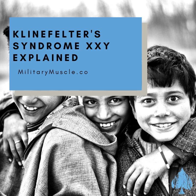 Klinefelter's Syndrome XXY