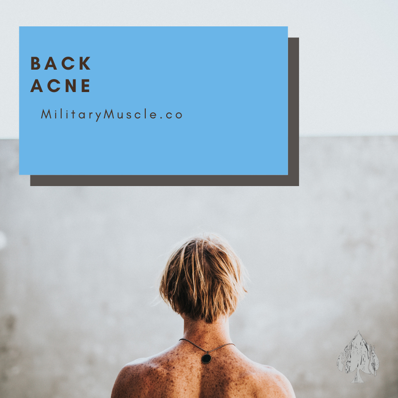 Back Acne after Steroid Use