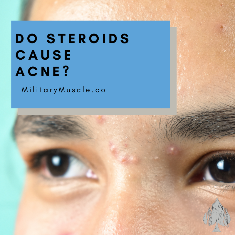Do Anabolic Steroids Cause Acne?